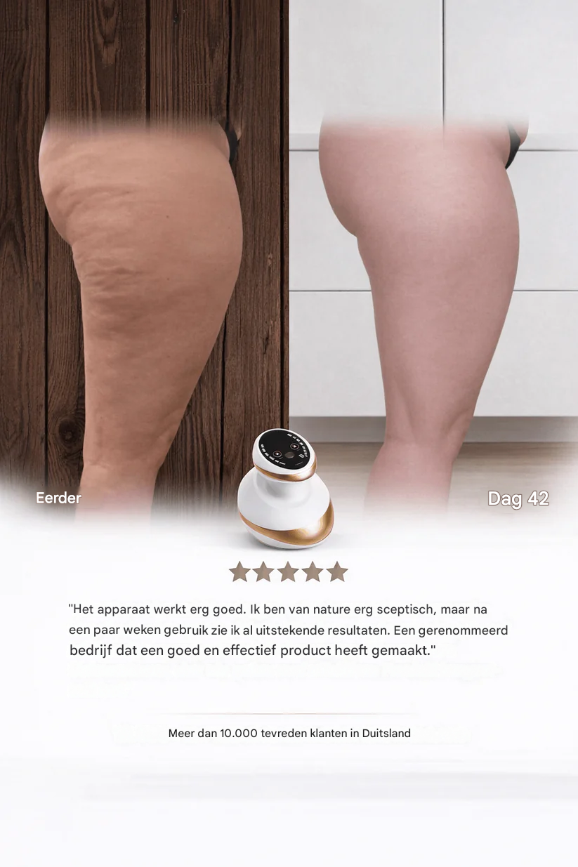 Sculptify™ Cellulite Massager