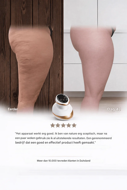 Sculptify™ Cellulite Massager