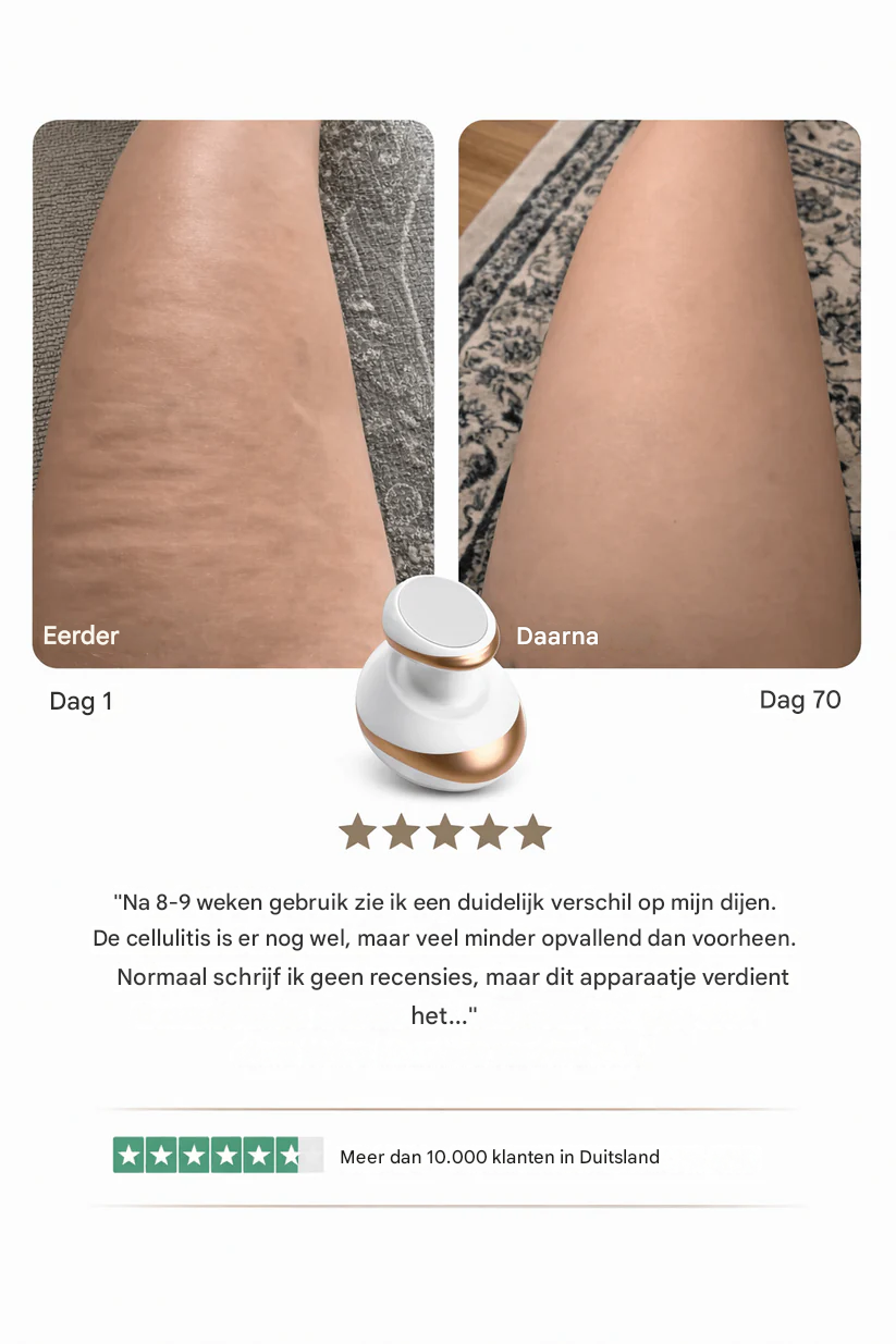 Sculptify™ Cellulite Massager