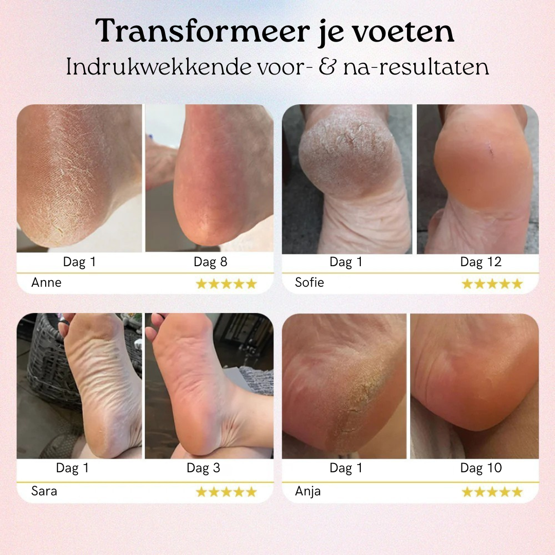 Salonresultaat thuis – zachte voeten in 5 minuten, zonder pedicure-kosten