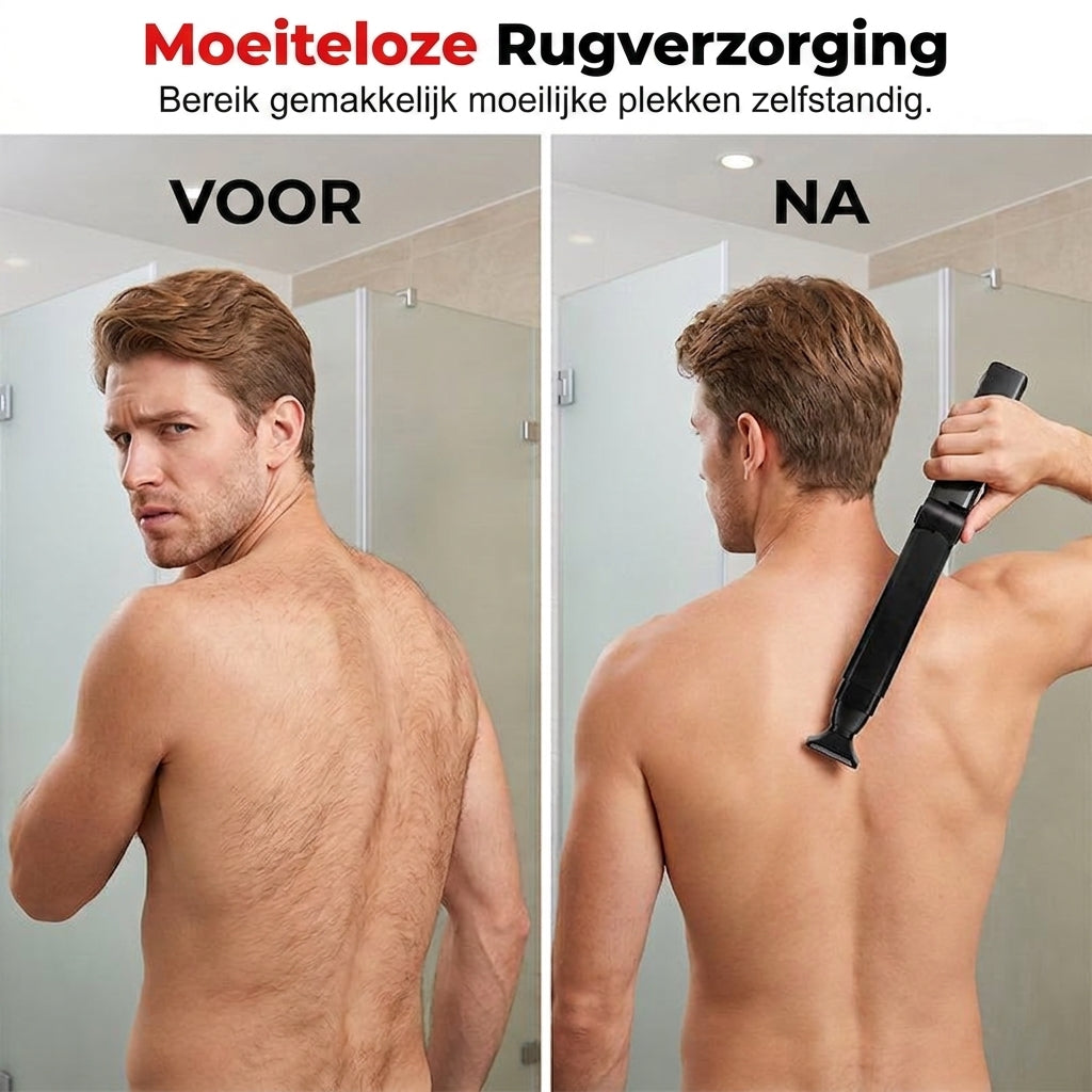 TrimReach™ | Overal bijscheren zonder snijden