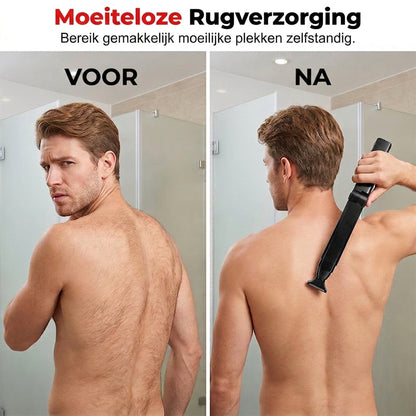 TrimReach™ | Overal bijscheren zonder snijden