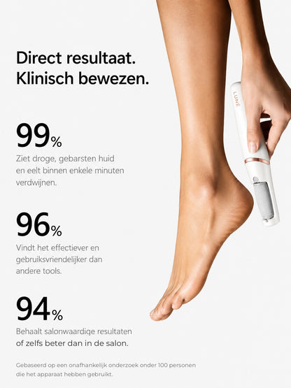 SilkStep™ Elektrische Eeltverwijderaar | Zachte, gladde voeten in 5 minuten — zonder raspen